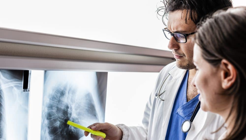 Brasileiros ainda desconhecem informações sobre câncer de pulmão, diz pesquisa