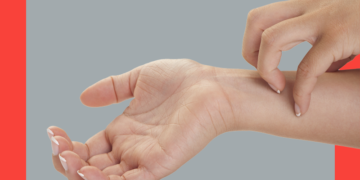 imagem ampliada de pessoa coçando o pulso em um fundo cinza com moldura vermelha